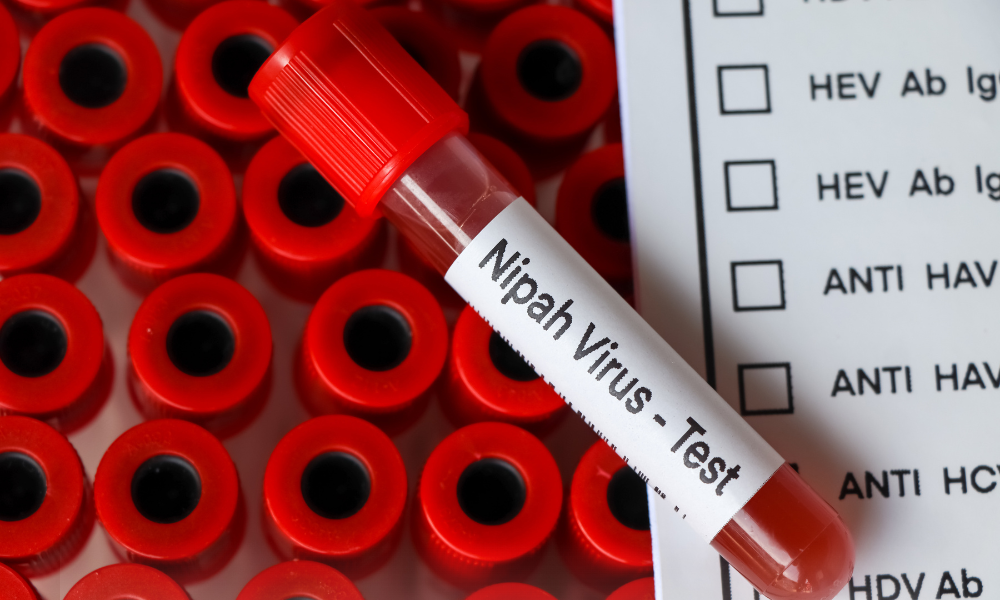 Virus Nipah Asia